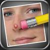 Pimple Eraser Icon