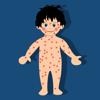 Rash Icon